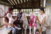 【画像】フィリピン人夫婦、3人連続でアルビノの子供を産む