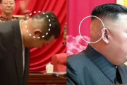 金正恩総書記の後頭部に｢医療用テープの痕｣か…健康状態が再び話題に！