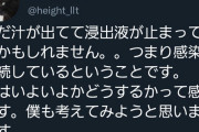 【悲報】骨延長の人、ついに切断か