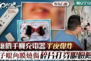 【速報】 中国、スマホ充電器が爆発！　横で寝ていた男性が失明寸前に　まぶたが吹き飛び、眼骨の皮膚筋肉は壊死、角膜は焼かれた