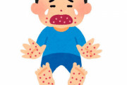【注意】 手足口病患者数が9週連続で増加中！千葉・新潟では警報基準値超え…コロナが長引き免疫を持たない人が増えたのが一因か