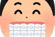 28歳やが歯列矯正しようか悩んでるｗｗｗｗｗｗｗｗｗｗｗｗ