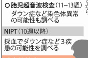 出生前診断で「異常なし」、生まれた子はダウン症　30代夫婦が病院に起こした訴訟の行方
