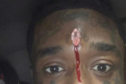 【Lil Uzi Vert】アメリカのラッパーさん、24億のダイヤモンドを額に埋め込み価値ある男になる