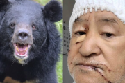 【熊被害】〈「クマを殺すな」の抗議殺到も…〉頭皮をはがされ頭蓋骨がむきだしになった被害者男性が独白「あの凶暴性はやられないとわからない」