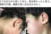 【画像】児童発達支援職員、子供にとんでもない体罰を与える→母親が告発、大炎上