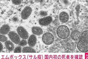 【ウイルス】ついに日本でも感染症「エムポックス」で死者…埼玉の30代男性、海外渡航歴なし