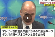 【佐賀大】アトピー性皮膚炎、ついに治る時代に突入か‥‥"かゆみ"原因を解明し薬を発見