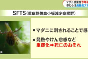 【悲報】広島で70代女性がマダニに噛まれて死亡…やばない？