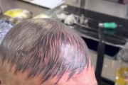 【朗報】頭に髪の毛のタトゥーを入れたハゲ男の動画がバズる。