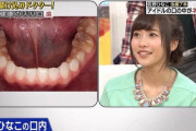 【悲報】アイドルの口の中、謎のゴミが見つかる