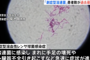 【緊急】『劇症型溶連菌』、過去最多