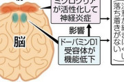 【衝撃】ADHDの疲れやすさは「脳の炎症」と関係がある説