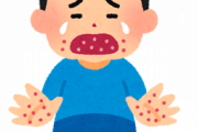 【育児】子供が発熱し手首に湿疹も出来たので病院へ。結果、手足口病ではなかった。しかし後日、私も発熱して湿疹ができてしまい、再度別の病院に行って診察してもらったんだが
