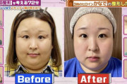 3時のヒロイン・かなで、整形ビフォーアフターを公開「そのクリニック、バズる！」整形総額6000万円・福岡みなみも絶賛