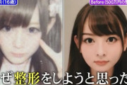 【悲報】女子高生「彼氏にブスブス言われた！…せや！整形したろｗ」