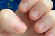 【画像】発達の指の爪、99%が「これ」