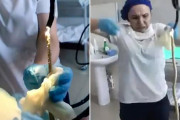 【ヤバすぎ】ロシア人女性の喉からヘビが摘出される　寝ている間に入った?？（※動画あり）