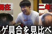【恐怖画像】この度、人気YouTuber「ゆゆうた」が公開したハゲ写真がヤバすぎる‥‥これがストレス性ハゲの恐ろしさか?