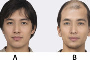 9割が薄毛の男性を採用しない　AI画像検証で衝撃結果