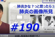 【あるある悲報】健康診断X線「肺に影があります」←これ