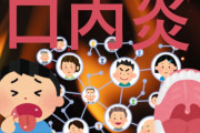 【急募】口内炎すぐ治す方法
