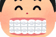 【悲報】学生の間に歯科矯正してもらえなかった奴...