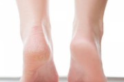 かかとのケア