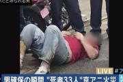 【衝撃】青葉真司容疑者 全身の90％をヤケドしていた・・・