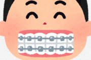 歯列矯正中の人おるか？