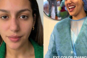 2024年は“瞳の色を変える”整形が流行！？　激変ぶりが海外SNSで話題になるも「恐ろしすぎる」と反対意見も殺到