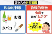 20年で2倍…増える若年層の「舌がん」 現代人特有の “狭い歯並び” が引き金に? 口内炎との決定的な違いとは