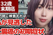 32歳美人YouTuber「痔だと思って放置してたらステージ4の大腸がんでした」
