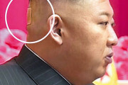 【悲報】金正恩の後頭部に貼り薬をはがした痕跡ｗｗｗｗｗｗｗｗｗｗｗ