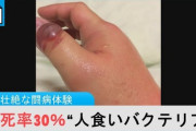 【溶連菌】人食いバクテリア　感染症が大流行中！傷口の消毒や手洗い・マスクが大事