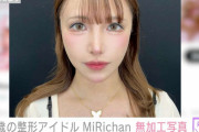 1000万円以上の整形公表“42歳の現役アイドル”MiRichan「完全無加工」の写真をファン大絶賛「美魔女」「20代にしか見えない」