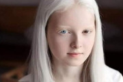 【画像】ロシアで生まれたアルビノと虹彩異色症を持った少女、ガチで神秘的過ぎるｗｗｗｗｗｗｗｗ
