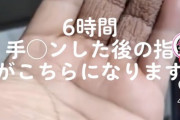 【画像】6時間手●ンをした男の指が凄い・・・