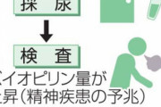 【画像】”精神疾患の予兆”を発見する検査キット、盛岡の企業が開発「尿に含まれる物質の量を測定」