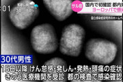【速報】サル痘感染者男性、7月中旬に帰国したものの25日まで受診せずｗｗｗｗ