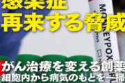 【朗報】サル痘、感染しても絶対にバレないと判明