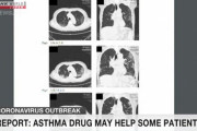 海外「日本で喘息薬がコロナウイルスに一定の効果を示すことが報告されたぞ」