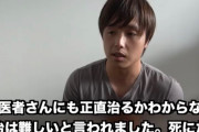 【閲覧注意】大人気YouTuberさん、難病になる「なんで俺だけ」「生きてる意味あんのかな」
