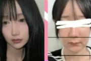 自業自得以外の感想はない　〜　【笑った顔は不自然だ】 「韓国で両顎手術を受け、口と顎が麻痺した」…日本人インフルエンサーが訴え