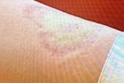 アジア大会…中国の女子柔道選手、日本人選手の腕に噛み付き反則負け [10/2]