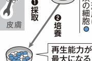 ハゲに朗報！ 移植後「生え替わる髪」開発、理研、臨床で実用化へ