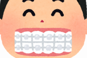 【悲報】『100万円の治療費』がパァに…歯科矯正の失敗はなぜ起こるのか？