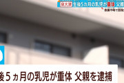 【終国】親ガチャ外した赤ちゃん（生後5ヵ月）、父親に噛みつかれて意識不明の重体…医者「回復の見込みがない」←ｴｯ!??