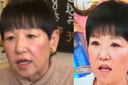 【悲報】和田アキ子、眼瞼下垂手術結果に納得いかず「ものすごい変な目になった」