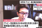 アトピー性皮膚炎の「かゆみの発生を抑える薬」臨床試験に成功　京都大学で世界初